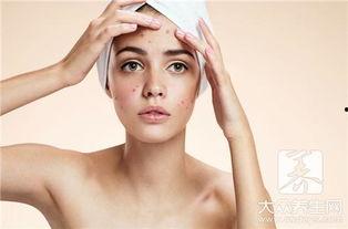 吃瓜吃出痘痘图片,揭秘吃瓜与痘痘的惊人关系